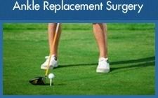 Ankle Replacement Surgery - Mr Htwe Zaw - Foot and Ankle Surgeon