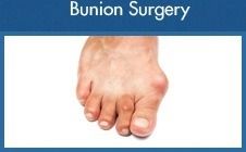 Bunion Surgery - Mr Htwe Zaw - Foot and Ankle Surgeon